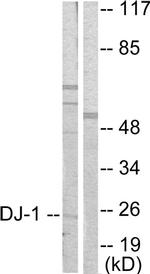 DJ-1 Antibody in Western Blot (WB)