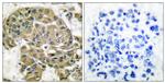 Mammaglobin B Antibody in Immunohistochemistry (Paraffin) (IHC (P))