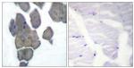 Phospho-Acetyl-CoA Carboxylase (Ser80) Antibody in Immunohistochemistry (Paraffin) (IHC (P))