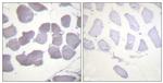 Phospho-AMPK beta-1 (Ser181) Antibody in Immunohistochemistry (Paraffin) (IHC (P))