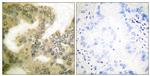 Phospho-Cyclin D3 (Thr283) Antibody in Immunohistochemistry (Paraffin) (IHC (P))