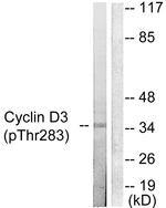 Phospho-Cyclin D3 (Thr283) Antibody in Western Blot (WB)