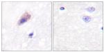 Phospho-Dynamin 1 (Ser774) Antibody in Immunohistochemistry (Paraffin) (IHC (P))