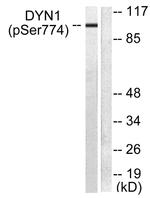 Phospho-Dynamin 1 (Ser774) Antibody in Western Blot (WB)