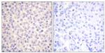 Phospho-FADD (Ser194) Antibody in Immunohistochemistry (Paraffin) (IHC (P))