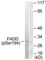 Phospho-FADD (Ser194) Antibody in Western Blot (WB)