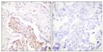 Phospho-FANCD2 (Ser222) Antibody in Immunohistochemistry (Paraffin) (IHC (P))