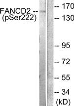 Phospho-FANCD2 (Ser222) Antibody in Western Blot (WB)