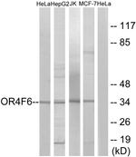 OR4F6 Antibody in Western Blot (WB)