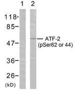 Phospho-ATF2 (Ser44, Ser62) Antibody in Western Blot (WB)