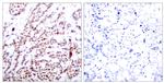 Phospho-ATF2 (Thr55, Thr73) Antibody in Immunohistochemistry (Paraffin) (IHC (P))