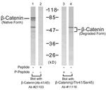 Phospho-beta Catenin (Thr41, Ser45) Antibody in Western Blot (WB)