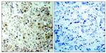 Phospho-CDK2 (Thr160) Antibody in Immunohistochemistry (Paraffin) (IHC (P))
