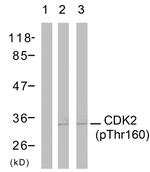 Phospho-CDK2 (Thr160) Antibody in Western Blot (WB)