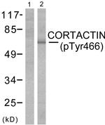 Phospho-Cortactin (Tyr466) Antibody in Western Blot (WB)