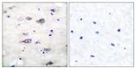 Phospho-GluR2 (Ser880) Antibody in Immunohistochemistry (Paraffin) (IHC (P))