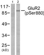 Phospho-GluR2 (Ser880) Antibody in Western Blot (WB)