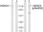 Phospho-HDAC4 (Ser632) Antibody in Western Blot (WB)