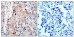 Phospho-ErbB2 (HER-2) (Tyr1221, Tyr1222) Antibody in Immunohistochemistry (Paraffin) (IHC (P))