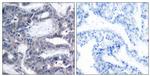 Phospho-MEK2 (Thr394) Antibody in Immunohistochemistry (Paraffin) (IHC (P))