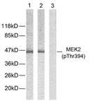 Phospho-MEK2 (Thr394) Antibody in Western Blot (WB)
