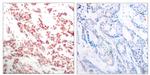Phospho-NFkB p52 (Ser865) Antibody in Immunohistochemistry (Paraffin) (IHC (P))