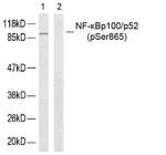 Phospho-NFkB p52 (Ser865) Antibody in Western Blot (WB)