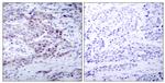 Phospho-NFkB p52 (Ser869) Antibody in Immunohistochemistry (Paraffin) (IHC (P))