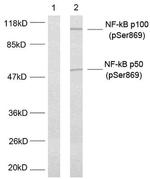 Phospho-NFkB p52 (Ser869) Antibody in Western Blot (WB)