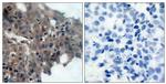 Phospho-p21 (Thr145) Antibody in Immunohistochemistry (Paraffin) (IHC (P))