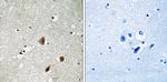 Phospho-PAK3 (Ser154) Antibody in Immunohistochemistry (Paraffin) (IHC (P))