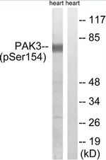 Phospho-PAK3 (Ser154) Antibody in Western Blot (WB)