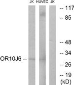 OR10J6P Antibody in Western Blot (WB)