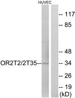 OR2T2/OR2T35 Antibody in Western Blot (WB)