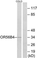 OR56B4 Antibody in Western Blot (WB)