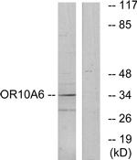 OR10A6 Antibody in Western Blot (WB)