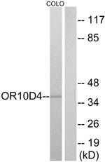 OR10D4P Antibody in Western Blot (WB)