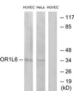 OR1L6 Antibody in Western Blot (WB)
