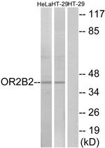 OR2B2 Antibody in Western Blot (WB)