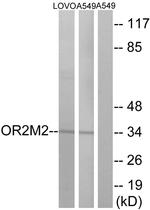 OR2M2 Antibody in Western Blot (WB)
