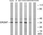 OR2M7 Antibody in Western Blot (WB)