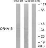 OR4A15 Antibody in Western Blot (WB)