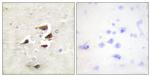 CaMKII alpha/beta/delta Antibody in Immunohistochemistry (Paraffin) (IHC (P))