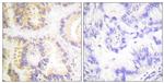 Phospho-Caspase 8 (Ser347) Antibody in Immunohistochemistry (Paraffin) (IHC (P))