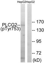 Phospho-PLCG2 (Tyr753) Antibody in Western Blot (WB)
