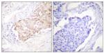 HYD Antibody in Immunohistochemistry (Paraffin) (IHC (P))