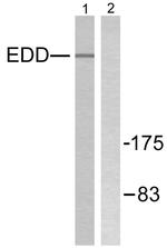 HYD Antibody in Western Blot (WB)
