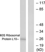 RPL10 Antibody in Western Blot (WB)