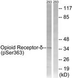 Phospho-OPRD1 (Ser363) Antibody in Western Blot (WB)