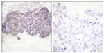 Phospho-HSL (Ser552) Antibody in Immunohistochemistry (Paraffin) (IHC (P))